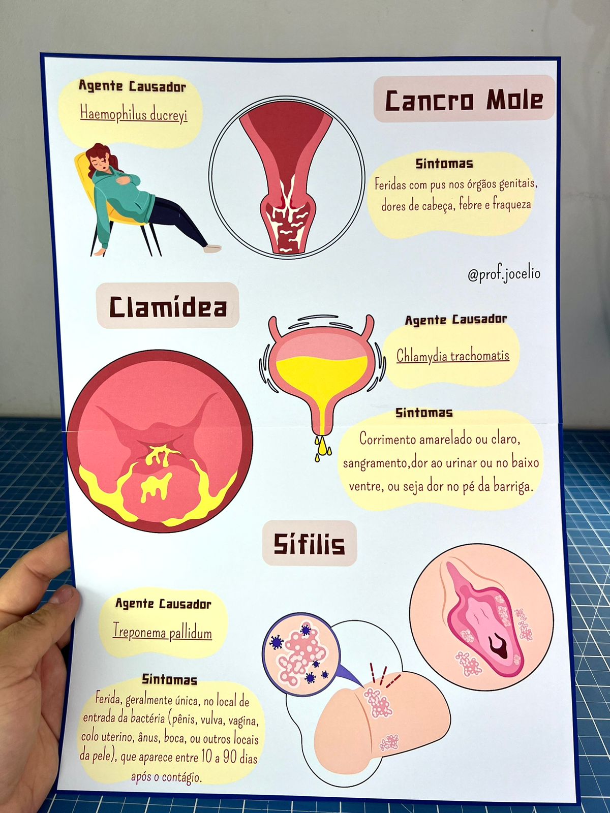 Infecções Sexualmente Transmissíveis - Cartazes - Imagem 4