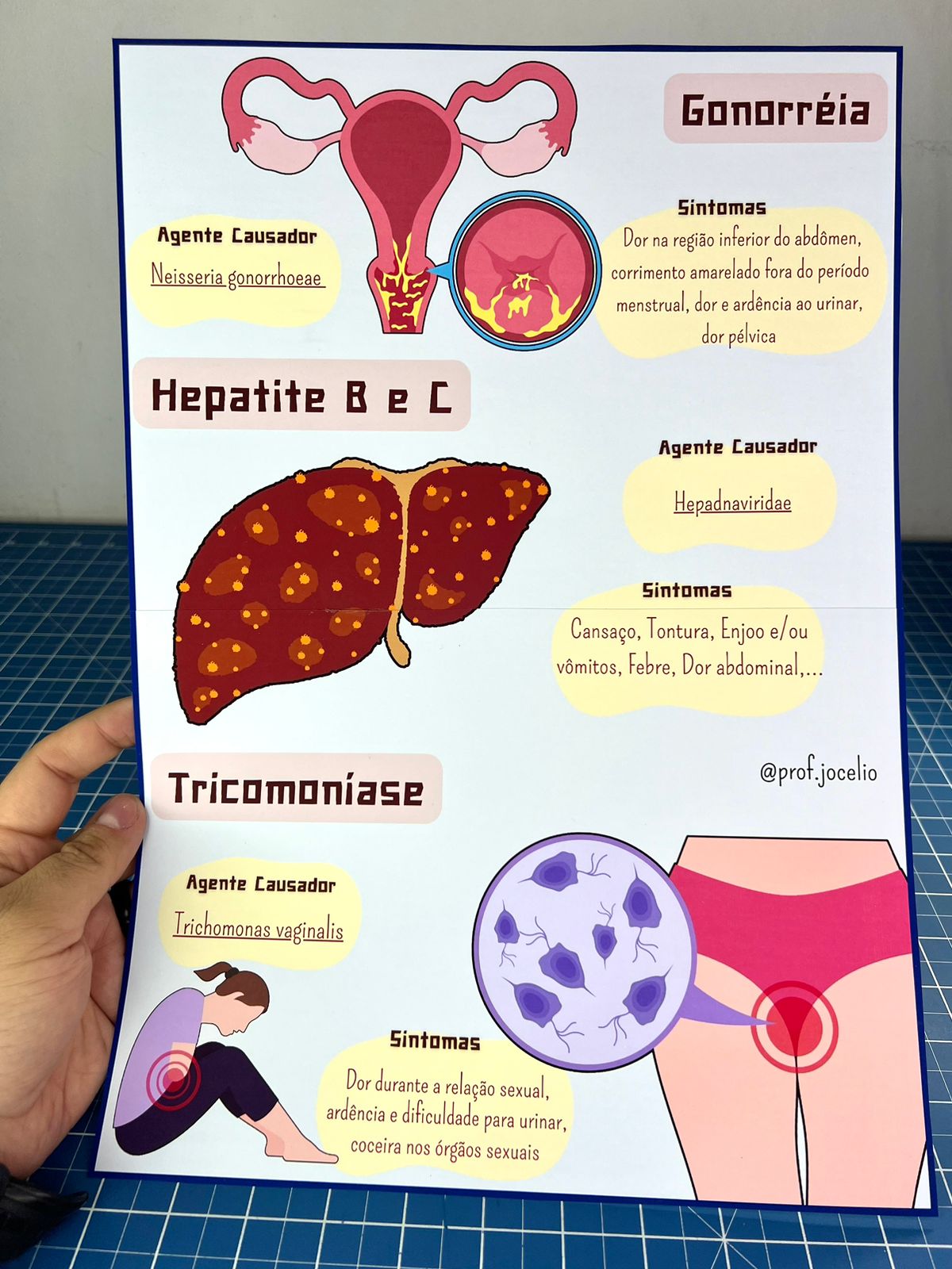 Infecções Sexualmente Transmissíveis - Cartazes - Imagem 2